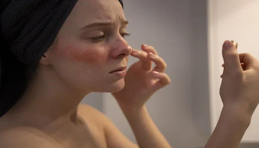 Advanced Treatment for Sensitive Skin: What You Need to Know
