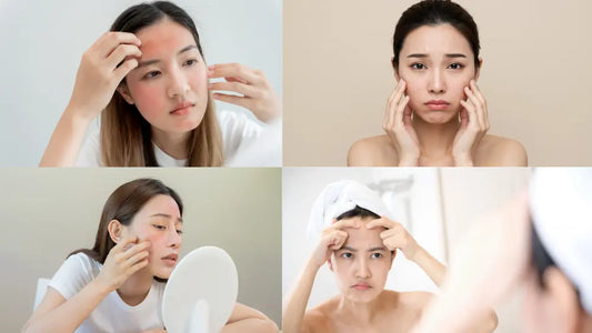 different girl have different skin care issues