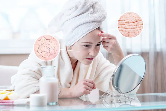 Why Is My Skin So Dry No Matter How Much Moisturizer I Use? The Hidden Reason Most People Miss